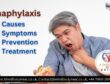 Anaphylaxis 2