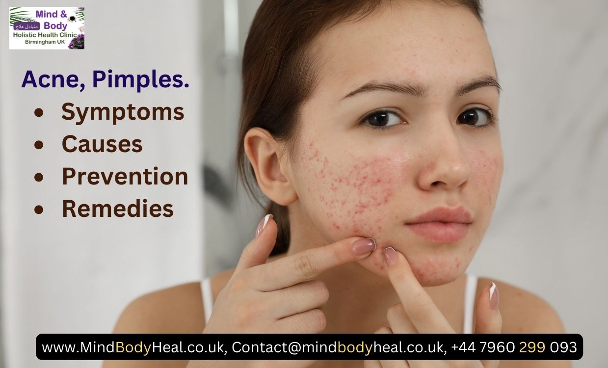 Acne, Pimples, Blackheads etc